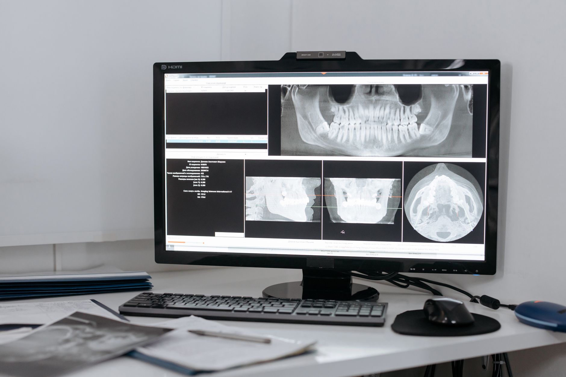 Ưu nhược điểm của từng dòng máy soi X-ray
