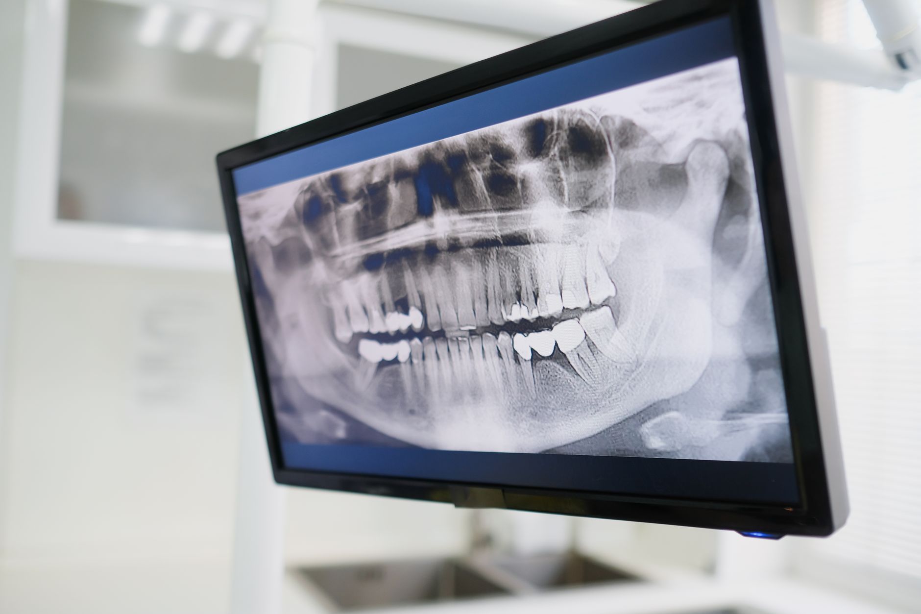 So sánh chi phí đầu tư & vận hành 3 dòng máy soi X-ray