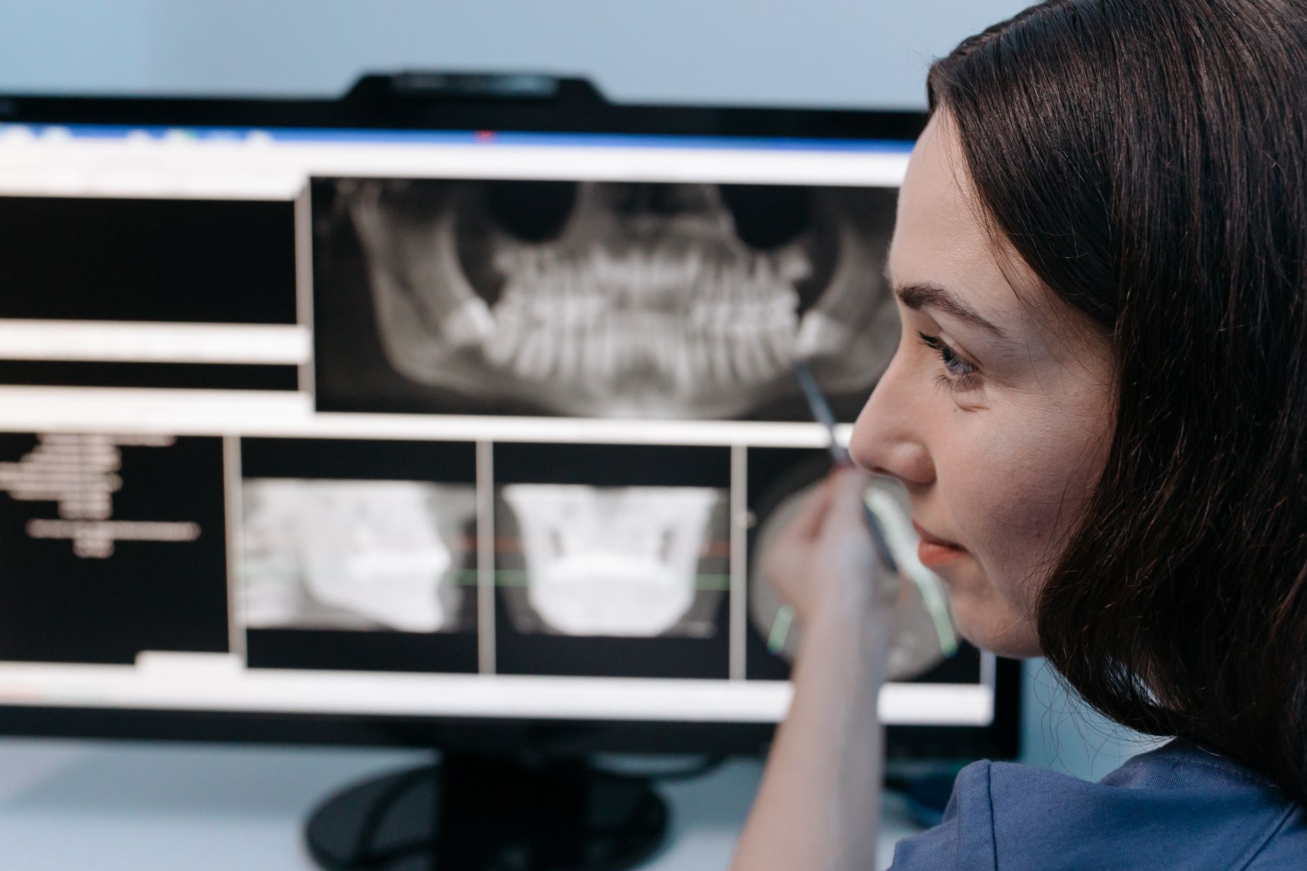 Máy soi X-Ray thực phẩm Anritsu Infivis XR75